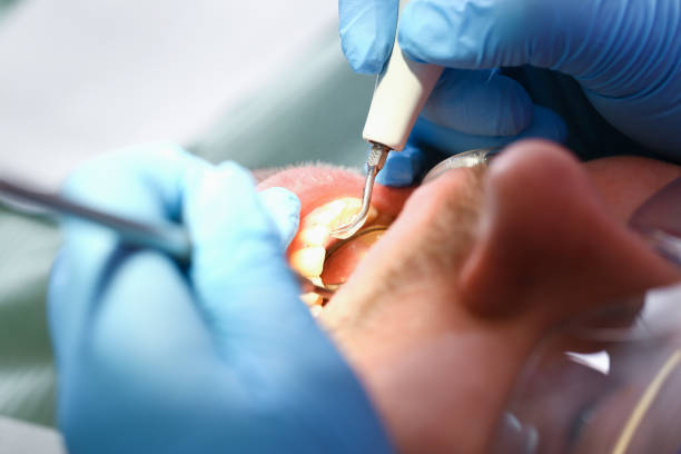 Emergency Dentist Open Today in WA