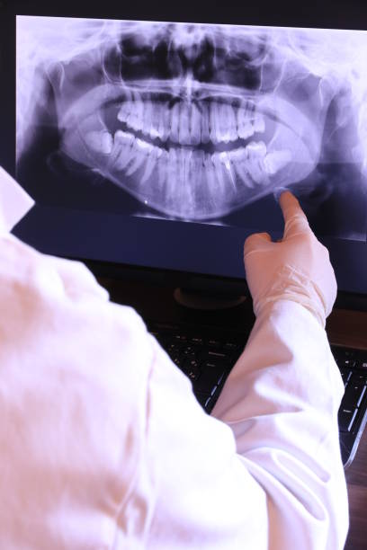 Best Dentist for Tooth Abscess  in Orchards, WA